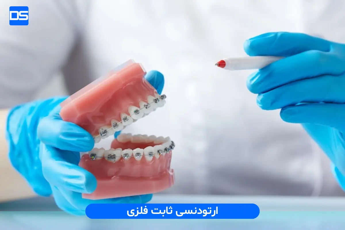 ارتودنسی ثابت فلزی