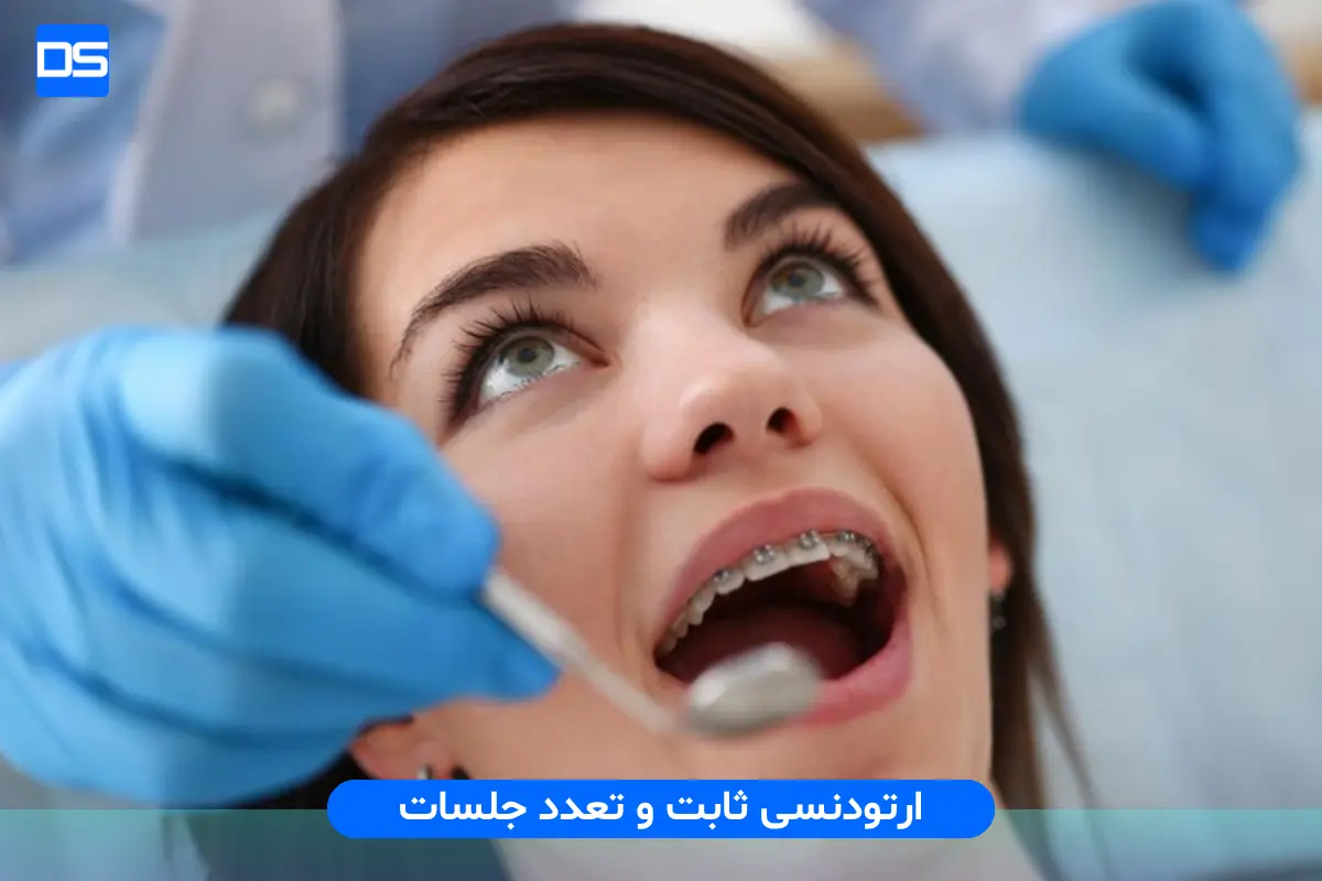 ارتودنسی ثابت و تعدد جلسات