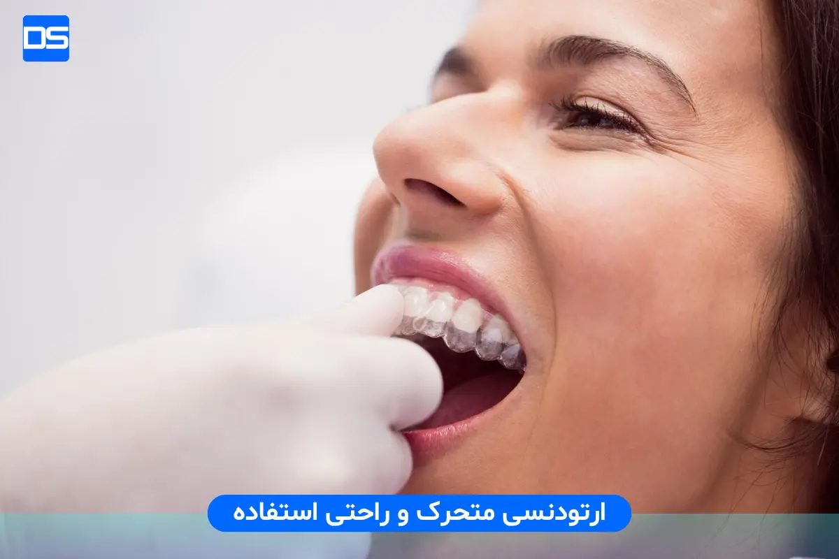 ارتودنسی متحرک و راحتی استفاده