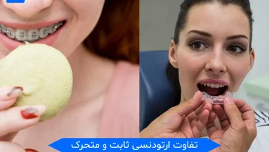 تفاوت ارتودنسی ثابت و متحرک